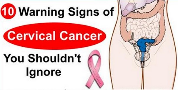 Here we give you 10 warning signs of cervical cancer you must not ignore. 
