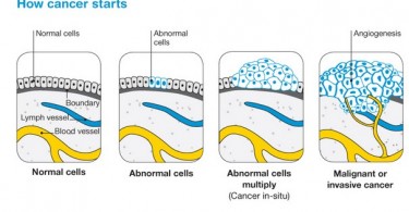 How cancer starts in the body