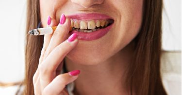 How Smoking Affects Your Teeth and Gums?