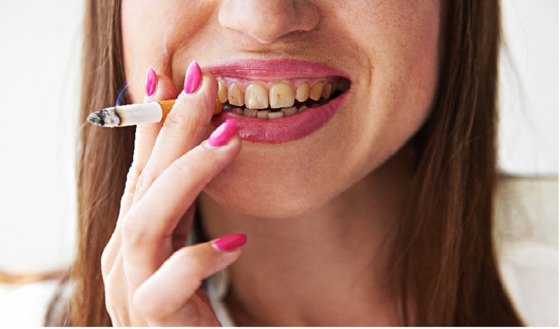 How Smoking Affects Your Teeth and Gums?