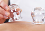 Cupping Therapy