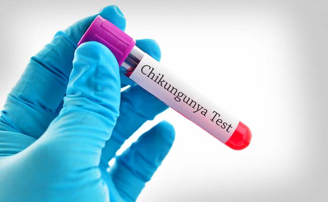 A Definite Guide to Everything about Chikungunya