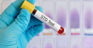 STD Screening Tests