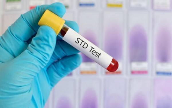 STD Screening Tests