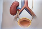 kidney failure