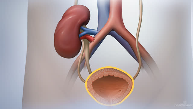 kidney failure