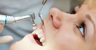 Key Benefits of Teeth Cleaning