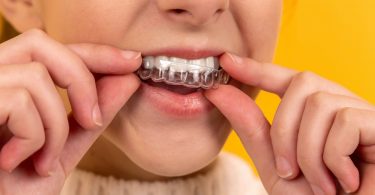 teeth straightening treatment
