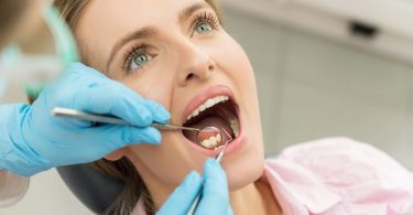 Common Dental Problems