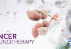 Cancer Immunotherapy