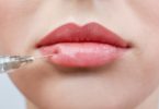 What is lip augmentation