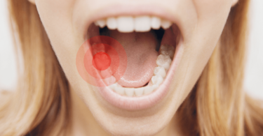 toothache