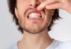 common causes of gum disease