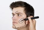 Most Common Plastic Surgeries for Men