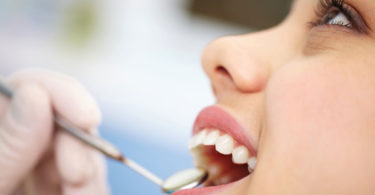 Regular Dental Visits