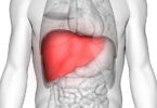 What is a Liver Transplant