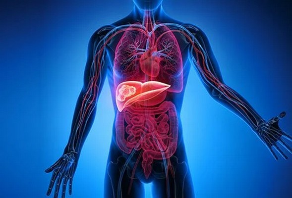 Types and Stages of Liver Cancer