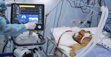 ECMO Treatment