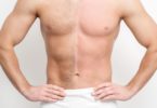 Unwanted Body Hair