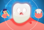Facts About Gum Disease
