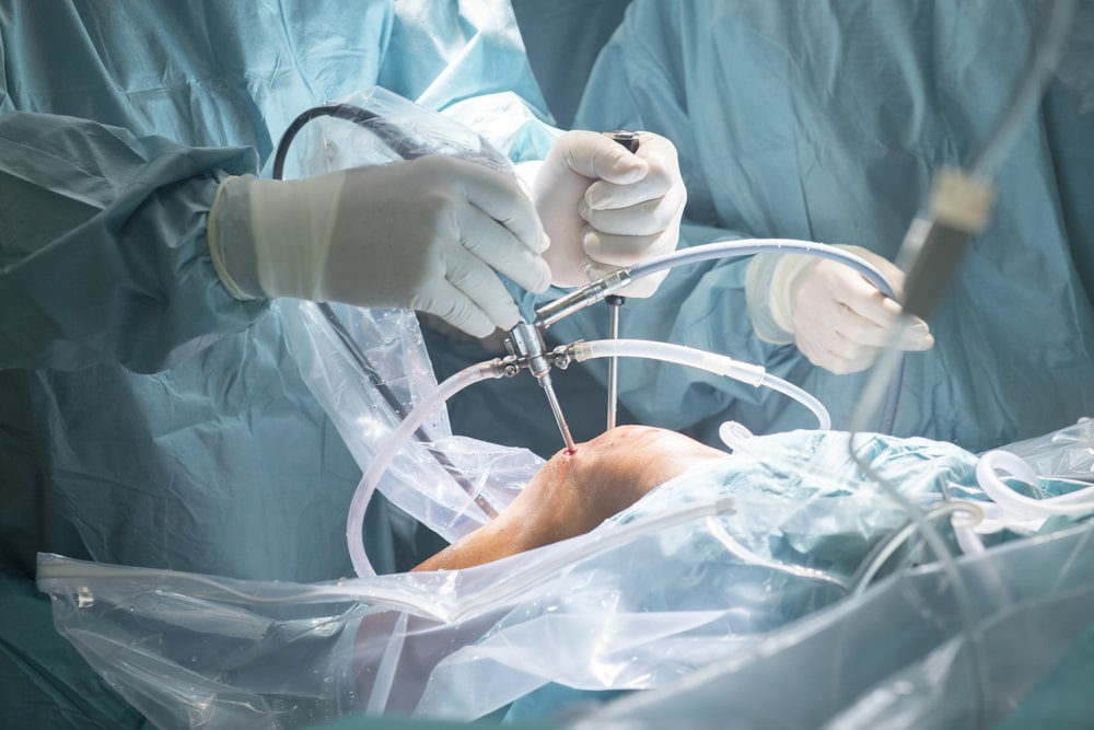 orthopaedic implants