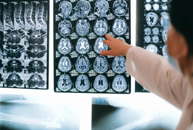 Tips to Care for a Child with Cerebral