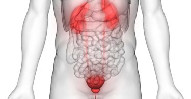 Urinary Bladder Cancer