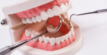 full mouth reconstruction rockwood tn