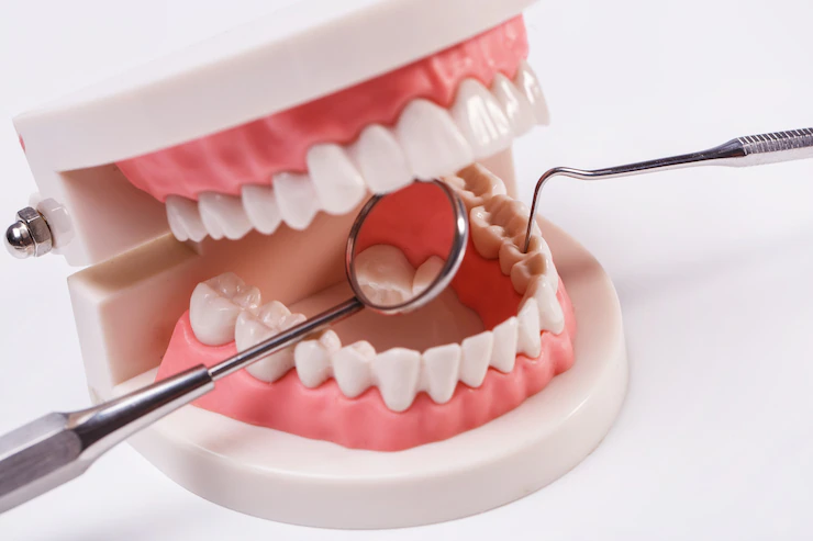 full mouth reconstruction rockwood tn