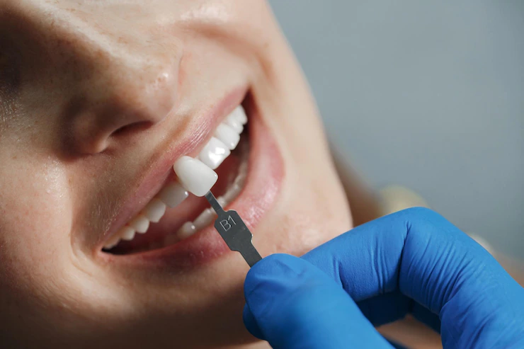 zoom teeth whitening Richfield oh