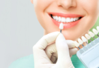 Process Of Porcelain Veneers