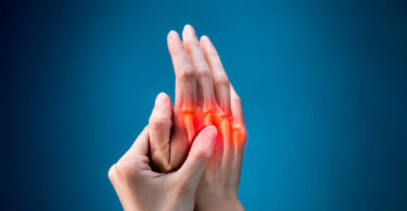 Pain, Finger, Human Hand, Joint - Body Part, Medical X-ray Arthritis Pain
