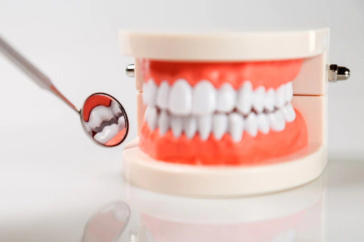 cost of dental implants