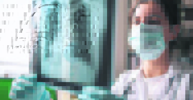 Tips to Prevent Lung Cancer