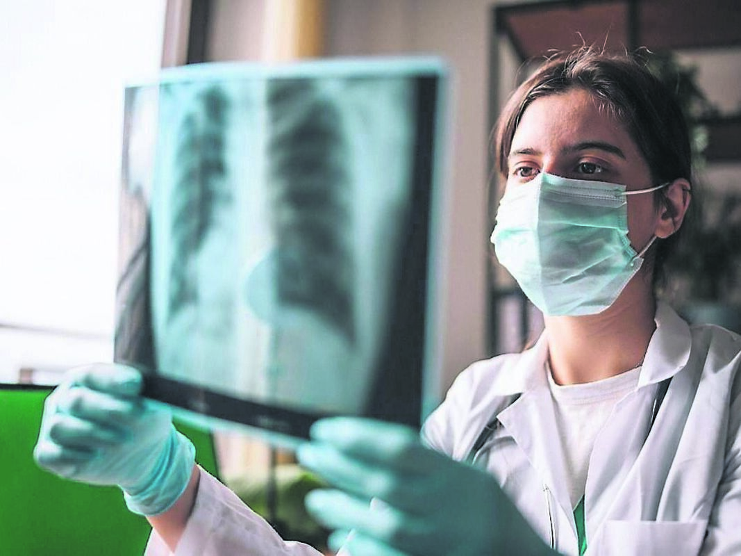 Tips to Prevent Lung Cancer