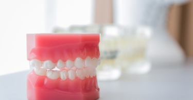 How to Take Care of Your Dentures