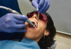 What Are Root Canals