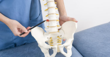 Facts About Herniated Discs