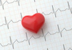 Reentry Arrhythmia