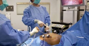 Bariatric Surgery