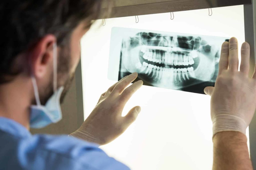 Why Dental X-Rays Are Necessary