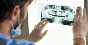 Why Dental X-Rays Are Necessary