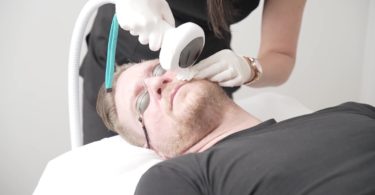 Intense Pulsed Light IPL Treatment