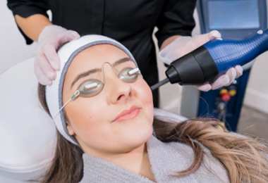 Skin Resurfacing Treatment Sydney