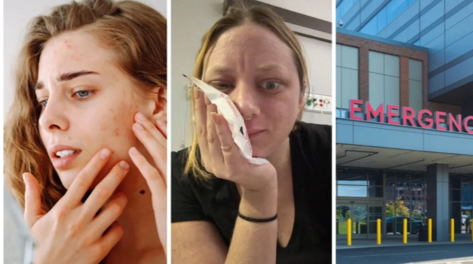 Triangle of Death face infection