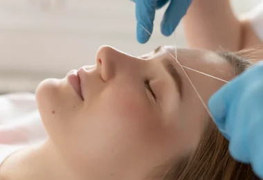 PDO thread lift face procedure
